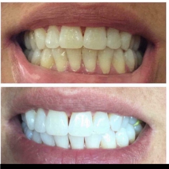 NWT Nu Skin AP 24® Whitening Fluoride Toothpaste - Picture 5 of 7